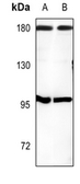 Anti-CUTL1 antibody used in Western Blot (WB). GTX56275