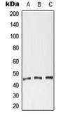Anti-Coxsackie Adenovirus Receptor antibody used in Western Blot (WB). GTX56276