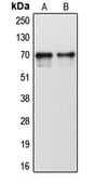 Anti-CYP1B1 antibody used in Western Blot (WB). GTX56279