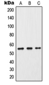 Anti-Cytochrome P450 2C9 antibody used in Western Blot (WB). GTX56285