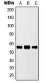 Anti-Cytochrome P450 2D6 antibody used in Western Blot (WB). GTX56286