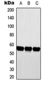 Anti-Cytochrome P450 2D6 antibody used in Western Blot (WB). GTX56287