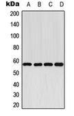 Anti-CYP2E1 antibody used in Western Blot (WB). GTX56290