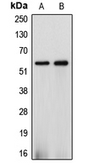 Anti-CYP2J2 antibody used in Western Blot (WB). GTX56291
