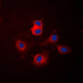 Anti-CYP17A1 antibody used in Immunocytochemistry/ Immunofluorescence (ICC/IF). GTX56294
