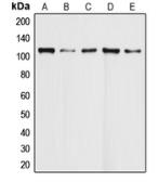 Anti-Daxx antibody used in Western Blot (WB). GTX56298
