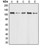 Anti-Daxx antibody used in Western Blot (WB). GTX56298