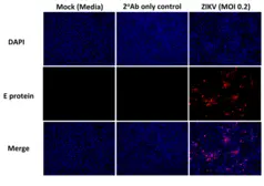 Anti-Flavivirus group antibody [D1-4G2-4-15 (4G2)] used in Immunocytochemistry/ Immunofluorescence (ICC/IF). GTX57154