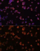 Anti-CD39 antibody used in Immunocytochemistry/ Immunofluorescence (ICC/IF). GTX57161