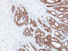 Anti-Cytokeratin 14 antibody [IHC555] used in IHC (Paraffin sections) (IHC-P). GTX57171