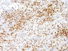 Anti-Annexin A1 antibody [IHC512] used in IHC (Paraffin sections) (IHC-P). GTX57177