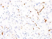 Anti-BSEP antibody [IHC518] used in IHC (Paraffin sections) (IHC-P). GTX57179