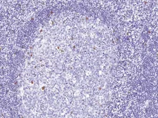 Anti-CD57 antibody [IHC539] used in IHC (Paraffin sections) (IHC-P). GTX57181
