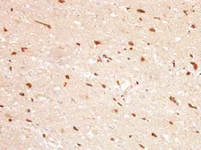 Anti-IDH1 (R132H Mutant Specific) antibody [IHC132] used in IHC (Paraffin sections) (IHC-P). GTX57185