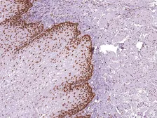 Anti-MSH6 antibody [IHC006] used in IHC (Paraffin sections) (IHC-P). GTX57188