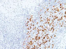 Anti-PD1 antibody [IHC001] used in IHC (Paraffin sections) (IHC-P). GTX57192