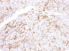 Anti-PD-L1 antibody [IHC411] used in IHC (Paraffin sections) (IHC-P). GTX57193