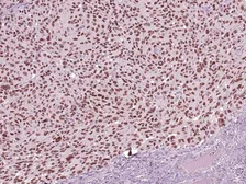 Anti-SOX10 antibody [IHC010] used in IHC (Paraffin sections) (IHC-P). GTX57197