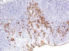 Anti-CTLA4 antibody [IHC004] used in IHC (Paraffin sections) (IHC-P). GTX57204