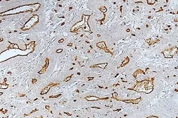 Anti-MUC1 antibody [014E] used in IHC (Paraffin sections) (IHC-P). GTX57210