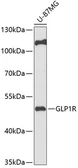 Anti-GLP1R antibody used in Western Blot (WB). GTX57214