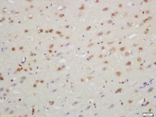 Anti-TXNIP antibody used in IHC (Paraffin sections) (IHC-P). GTX57221