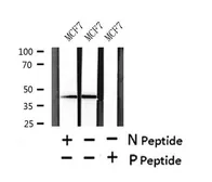 Anti-STING (phospho Ser366) antibody used in Western Blot (WB). GTX57223