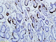 Anti-Gastrin antibody used in IHC (Paraffin sections) (IHC-P). GTX57227