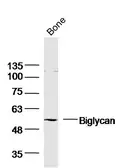 Anti-Biglycan antibody used in Western Blot (WB). GTX57229