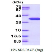 Human UNC119B protein, His tag. GTX57244-pro