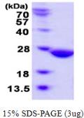 Human ABHD14B protein, His tag. GTX57247-pro