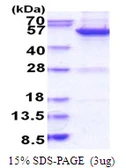 Human MINA53 protein, His tag. GTX57249-pro