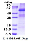 Human ZNF514 protein, His tag. GTX57251-pro