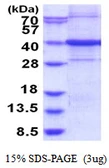 Human ARHGEF39 protein, His tag. GTX57252-pro