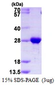 Human RAB2B protein, His tag. GTX57253-pro
