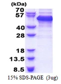 Human RBM17 protein, His tag. GTX57254-pro