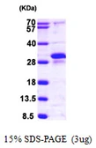 Human RERG protein, His tag. GTX57255-pro