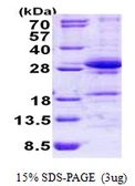 Human DGCR6L protein, His tag. GTX57257-pro