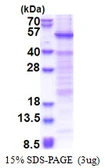Human HSFY1 protein, His tag. GTX57258-pro