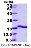 Human A2LD1 protein, His tag. GTX57259-pro