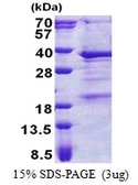 Human THAP3 protein, His tag. GTX57261-pro