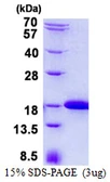 Human IFT20 protein, His tag. GTX57262-pro