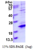 Human TCEAL8 protein, His tag. GTX57265-pro