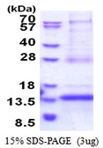 Human CDKN2AIPNL protein, His tag. GTX57267-pro