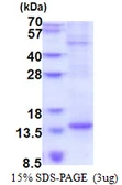 Human BTF3L4 protein, His tag. GTX57268-pro