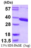Human ACY3 protein, His tag. GTX57269-pro