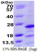 Human Mimitin protein, His tag. GTX57271-pro