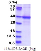 Human LYK5 protein, His tag. GTX57273-pro