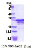Human RBM18 protein, His tag. GTX57274-pro