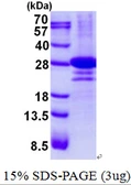 Human DTD1 protein, His tag. GTX57278-pro